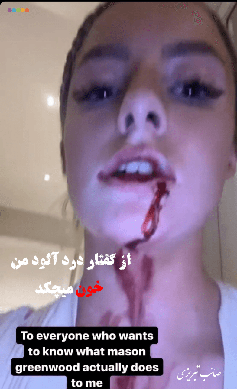 از گفتار درد آلود من خون میچکد ??