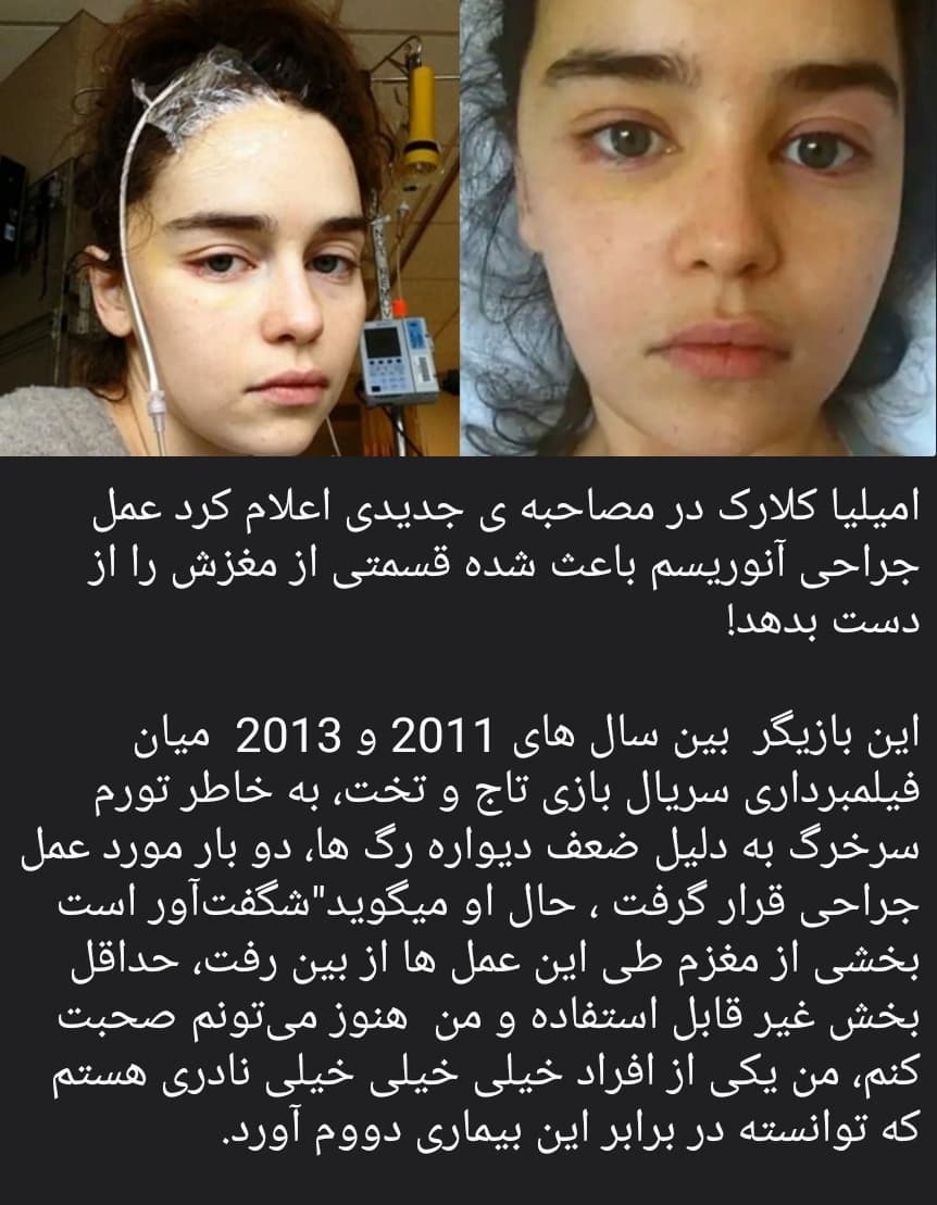 لعنتی تو نباید چیزیت بشه تو مادر اژدهایی