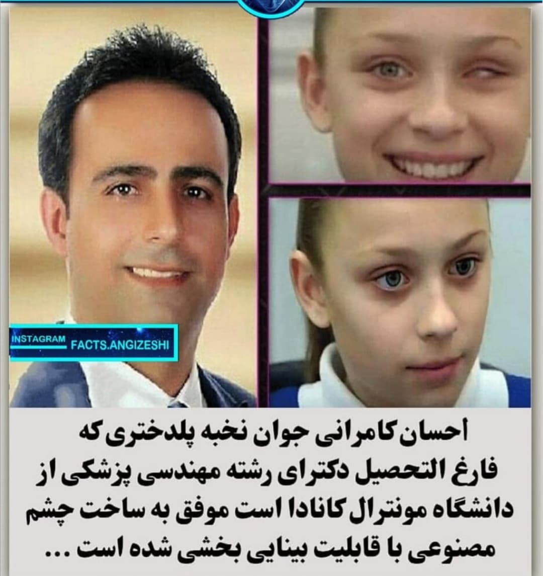 ???ساخت چشم مصنوعی توسط نخبه ایرانی(اهل پلدختر)