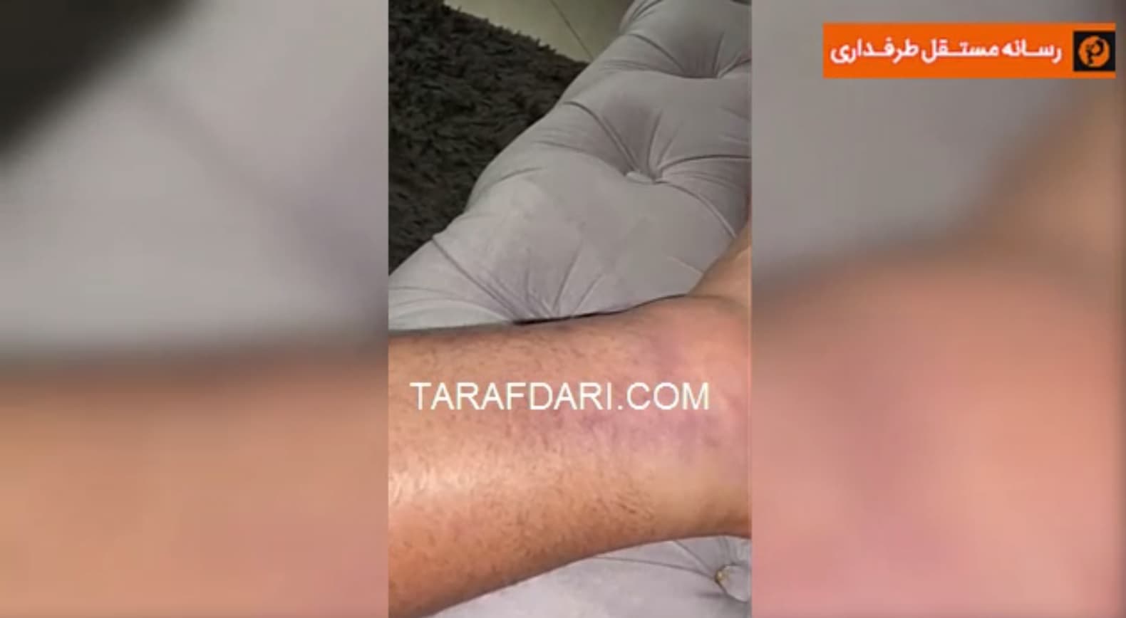 کنعانی زادگان برای مصدومیت خود سند رو کرد/ فیلم اختصاصی طرفداری