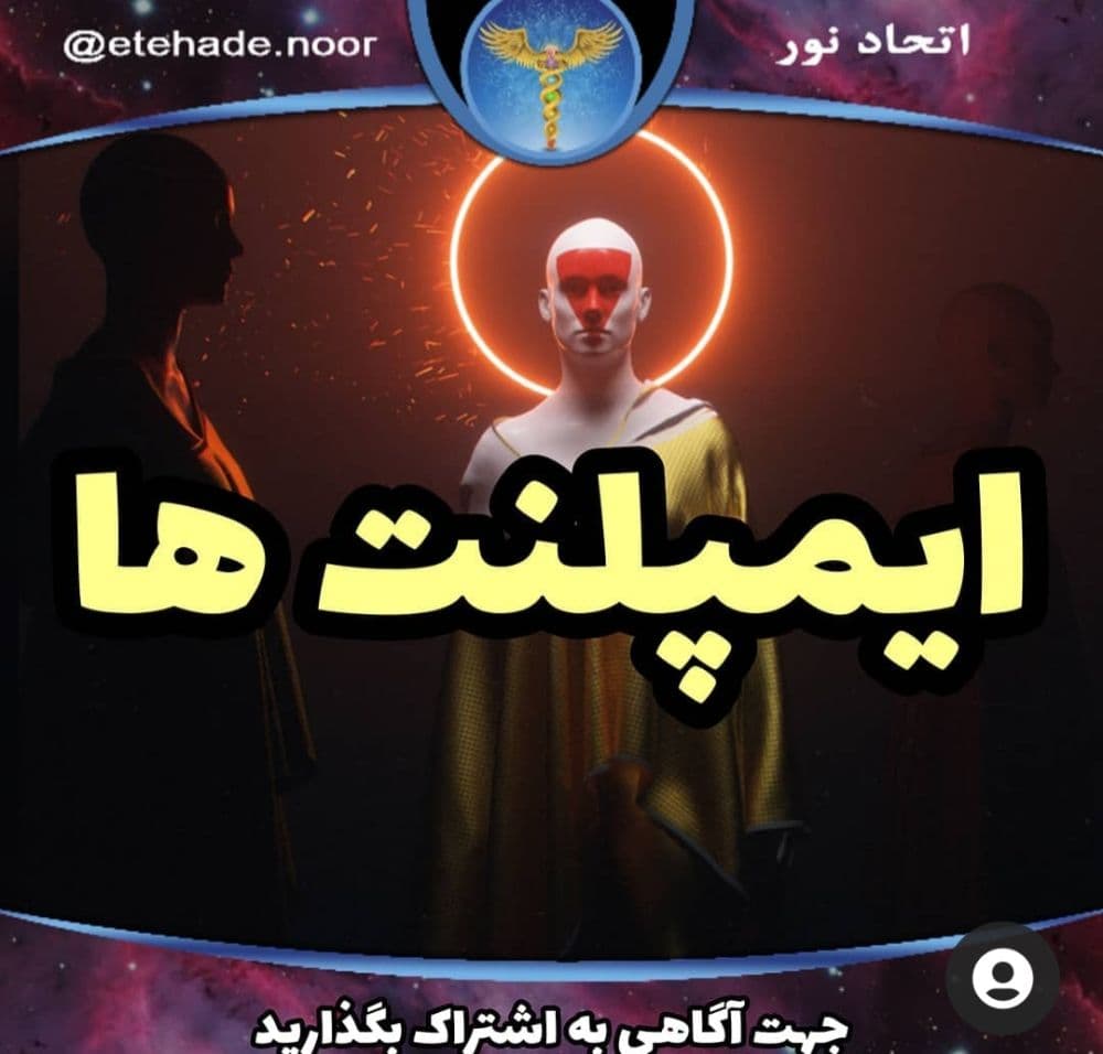 ایمپلنت ها - اتحاد نور